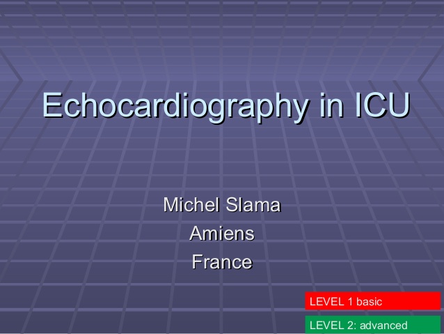 Echocardiography in ICU 