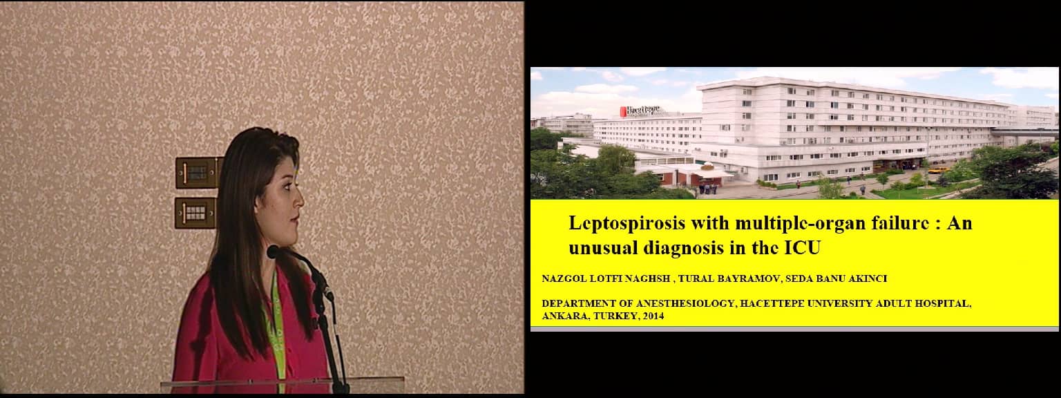Leptospirosis with multiple-organ failure: An unusual diagnosis in the ICU